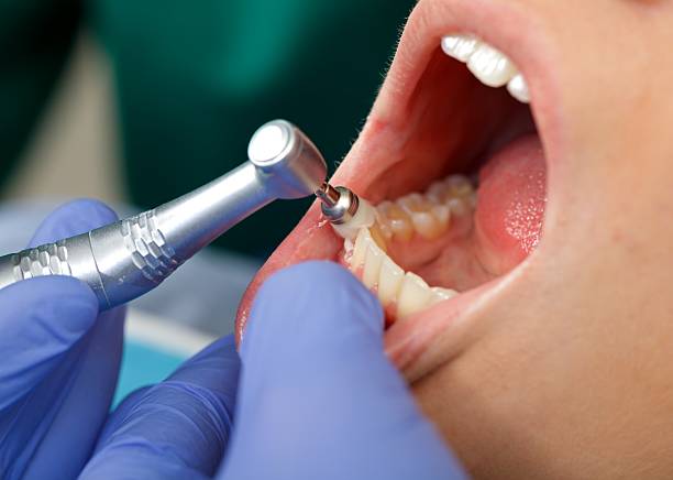 Best Tooth Extraction  in Central Islip, NY